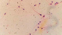 CIENCIA Y SALUD. HyperSperm: la tecnología de capacitación espermática creada por científicos del CONICET Rosario avanza hacia la mejora de las tasas de embarazo en fertilización in vitro